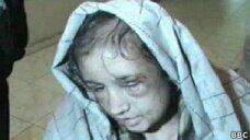 Афганскую девочку-подростка жестоко пытала семья мужа