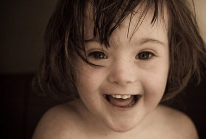 Синдром Дауна улыбка Синдром Дауна улыбка