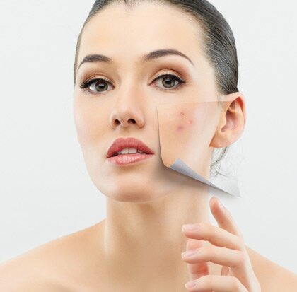 Тональный крем для проблемной кожи прыщи