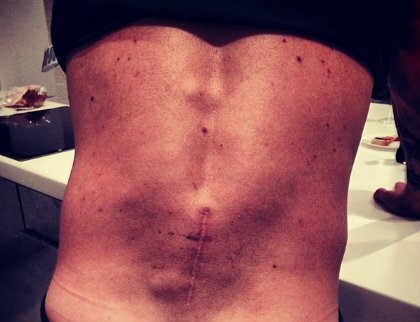 Фото спины Плющенко из Instagram Ксении Собчак