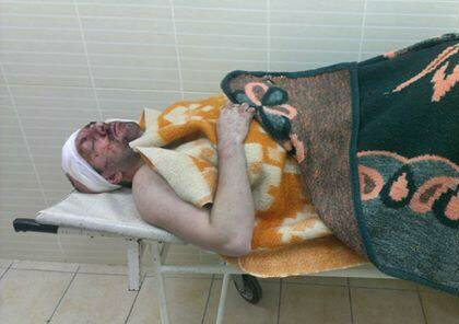 Пострадавший во время митинга в Донецке