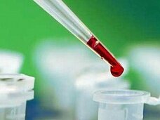 Болезнь Альцгеймера предскажут по анализу крови