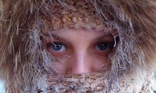 Обморожение - как оказать первую помощь себе и близким