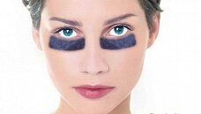 Отеки под глазами: причины возникновения и методы борьбы